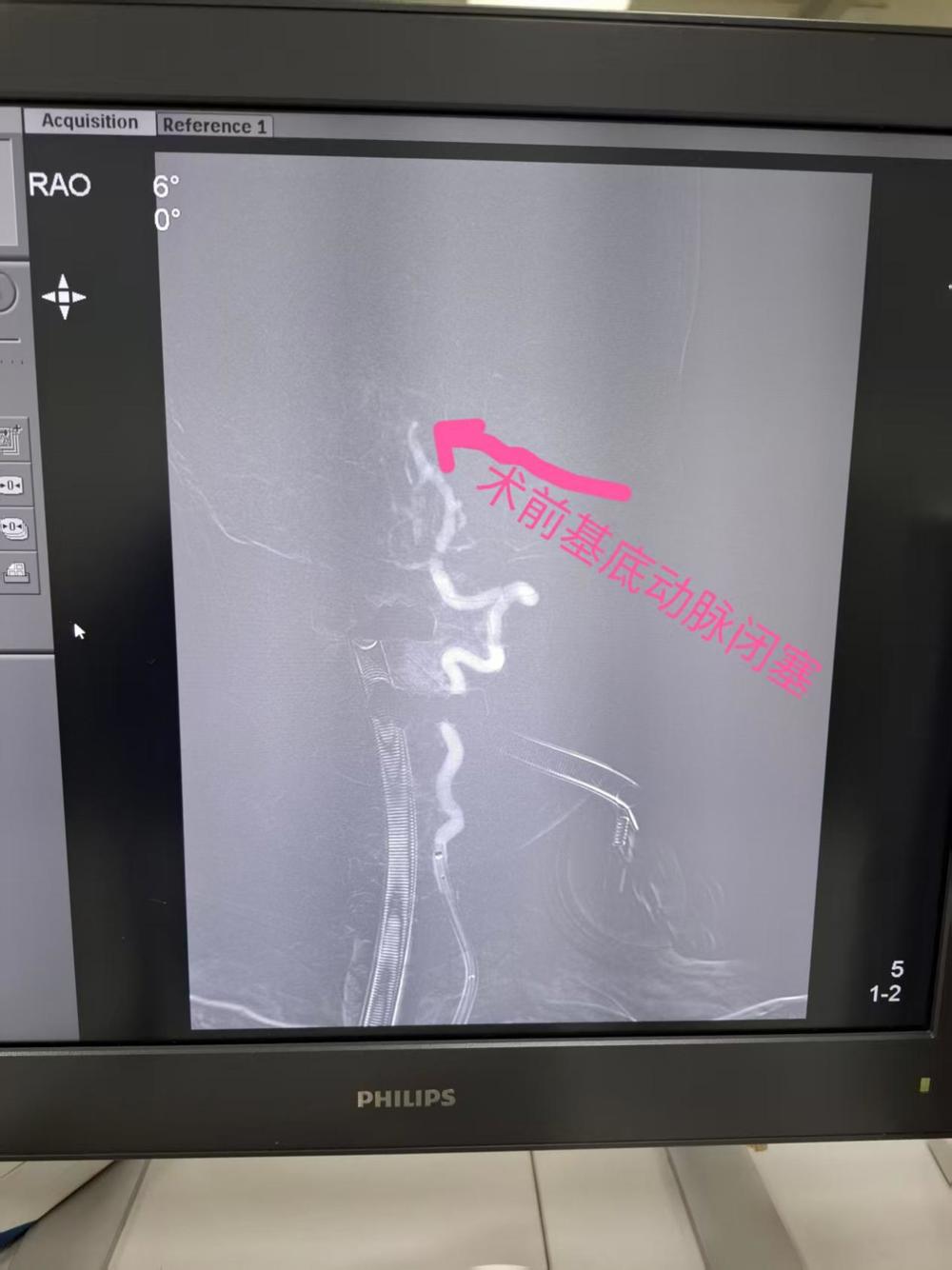 598e57c84746c9fd724481a2d939ca4