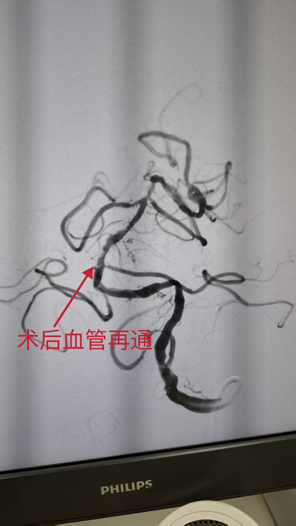 7975ee1b3b905c50a4b2326984dfbbf