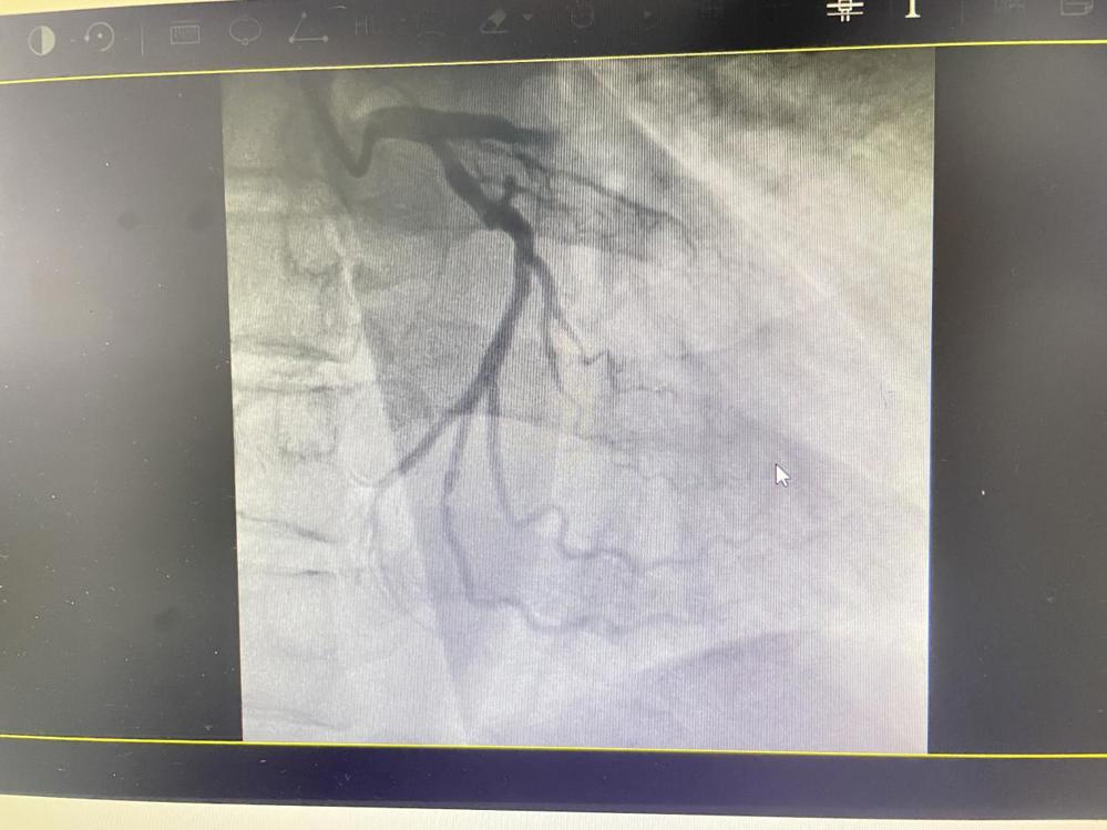 55d0f03839d9af1682708c7d0b5316f