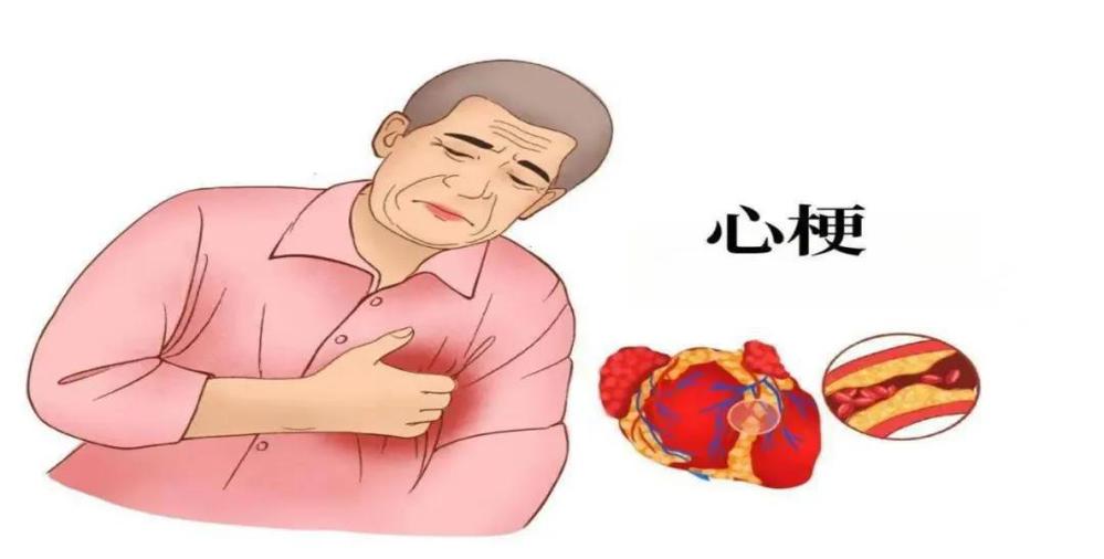 dd828766f89e6799f79acee76378a8a