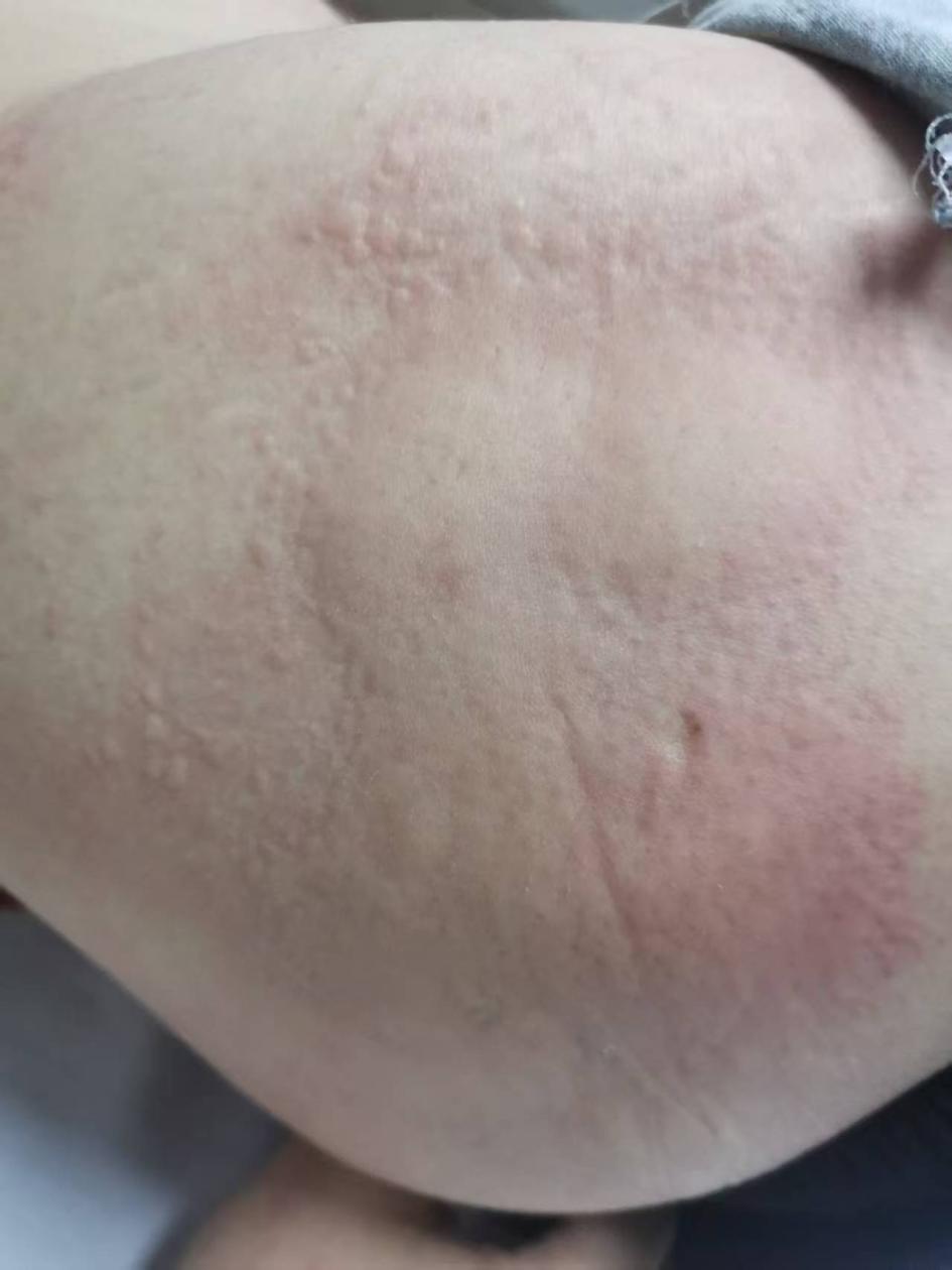 8c2456b03fd00c190d960c86a7a5324