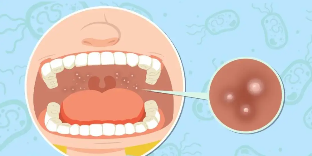 11e2c46317bb95b100e3304231e2687