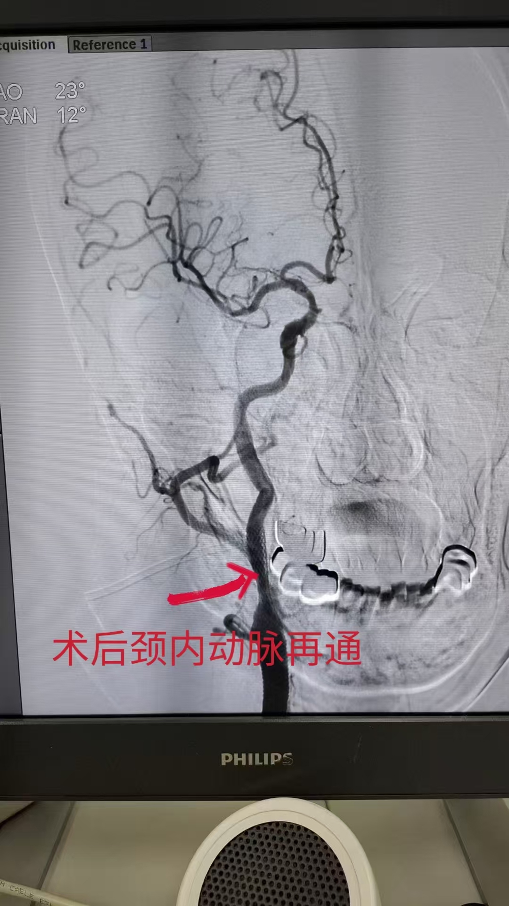 09ccc27a429bdc5cf066fe4ad108b61