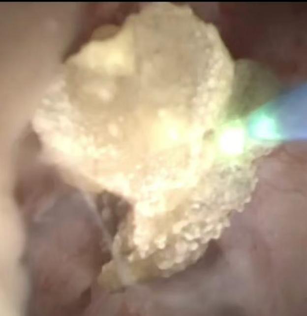 eacd269c09760bdce126c78a68d65ba