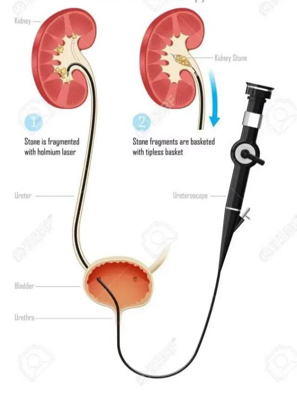 dac73ccb6cca2fd76169bda1df9ad4d