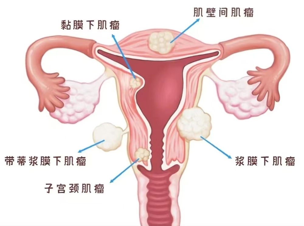 7d4004217c0d17058d660c1196eb06b7