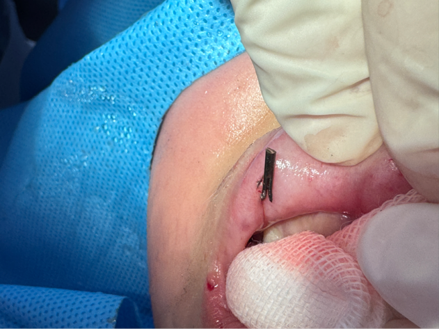 2026-03-17 11:03:02.495000