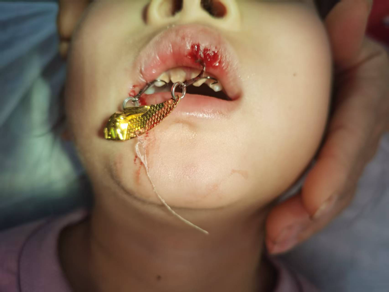 2026-03-17 11:00:51.746000