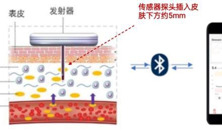 告别天天扎手指！动态血糖监测了解一下