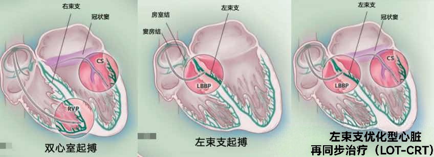 ec0b6ca8cac9d09e0dc992570fca0cd0